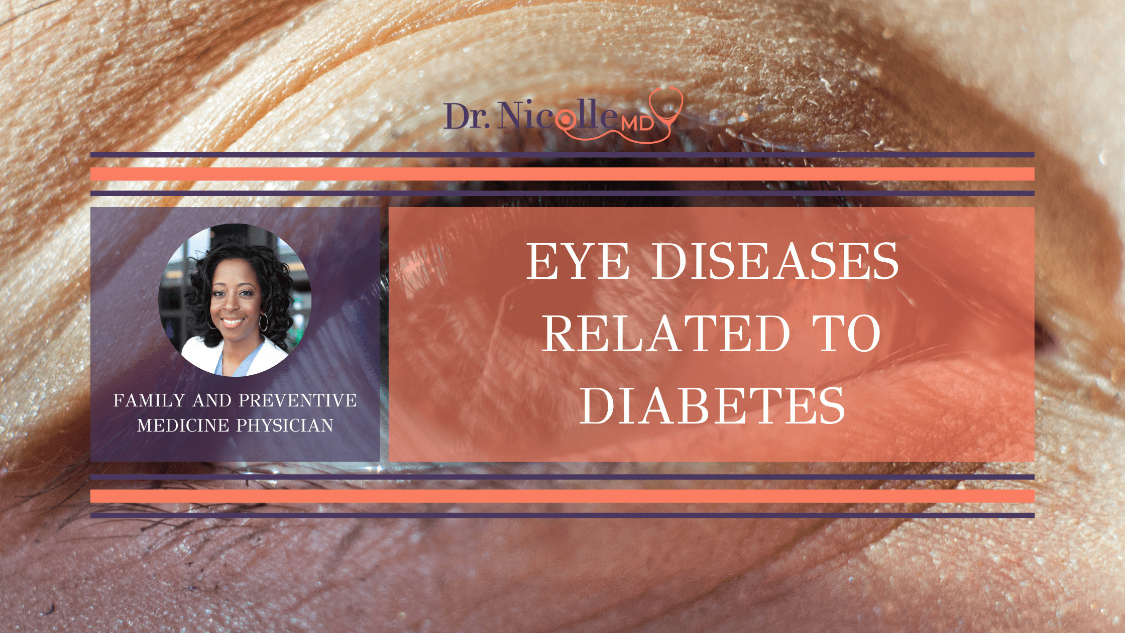 11Eye-Diseases-Related-to-Diabetes